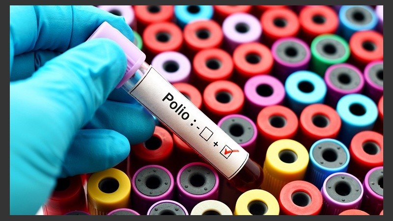 Polio positive