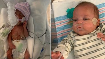 Su condición de bebé “prematuro extremo” le daba sólo un 14% de sobrevivencia, según las estadísticas.