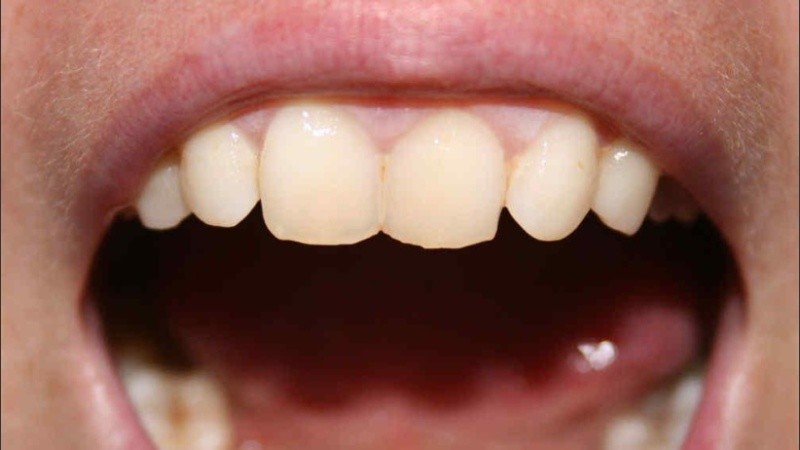 Se puede aprender a autoexaminar la boca. 