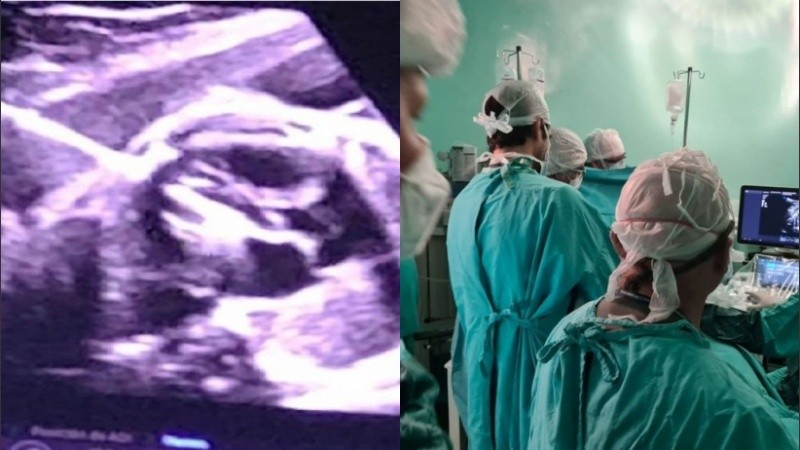 El desarrollo de las cirugías fetales comenzó a especializarse en 1998 y en el país la primera se realizó en 2005.