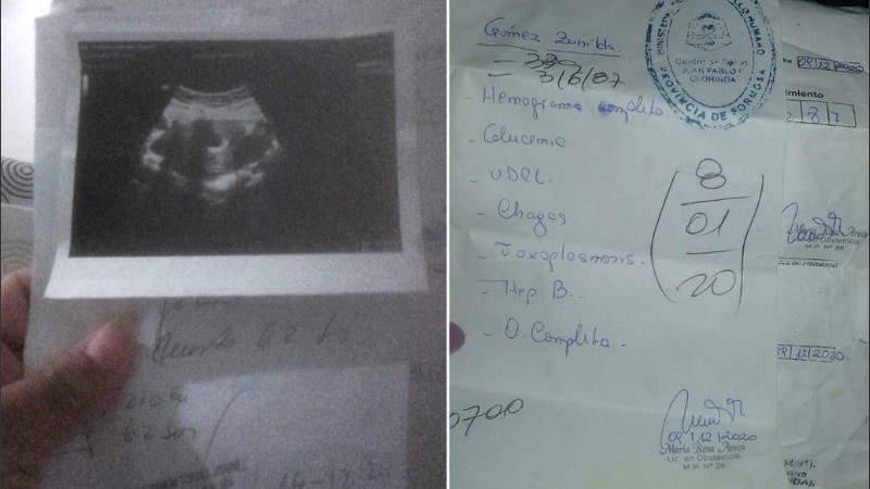 La mujer reclamó la copia de su historia clínica en el hospital, donde le dijeron que la habían extraviado.