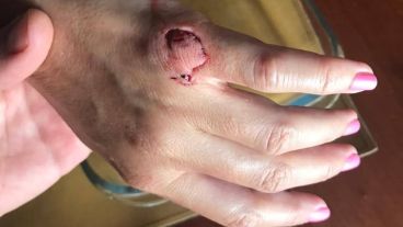 Las palometas atacaron otra vez en el río Paraná.