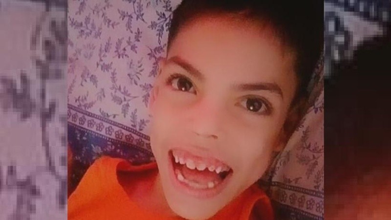 Por su condición, Benjamín no puede tragar y todo lo que come tiene que estar procesado.