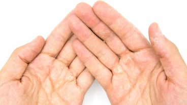 Cómo ayudar a que la piel de las manos se mejore con sencillos tips