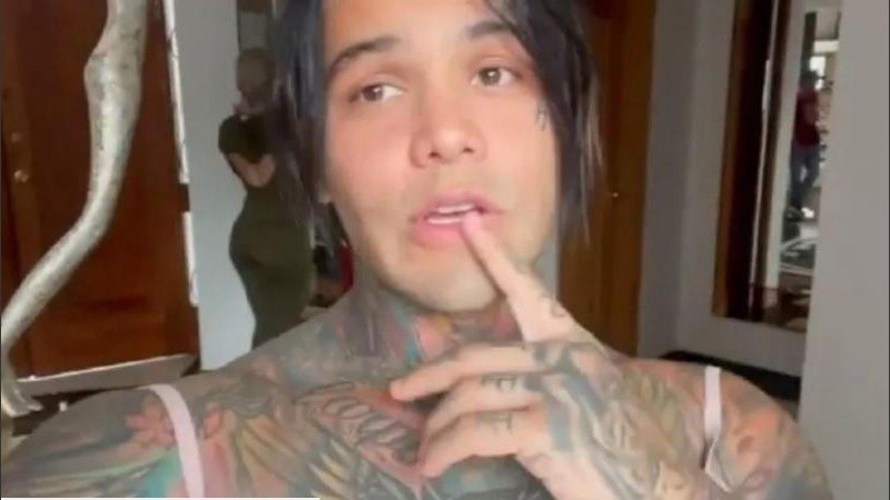 El joven quedó contento con la cirugía.