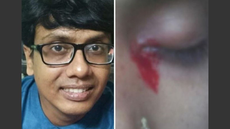 La causa exacta de la afección es incierta.