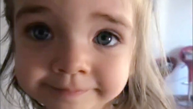 Valentina necesita un tratamiento muy costoso para la enfermedad hereditaria.