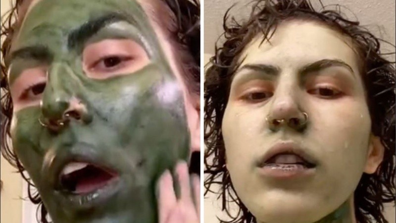 La joven no logró sacarse el color verde de la piel por algunos días.