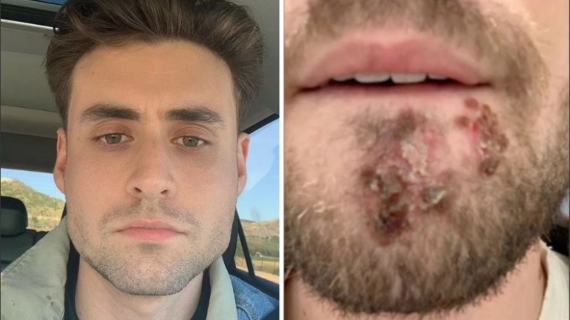 El joven logró recuperarse.