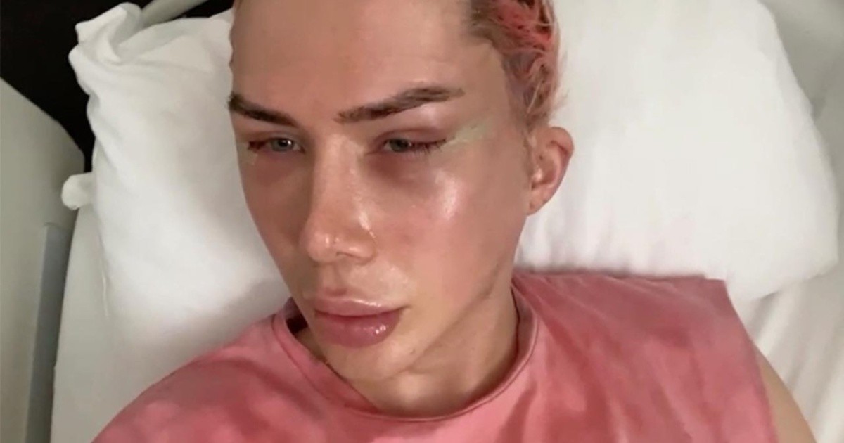 Oli London, el influencer inglés que se operó 18 veces para ser coreano ...