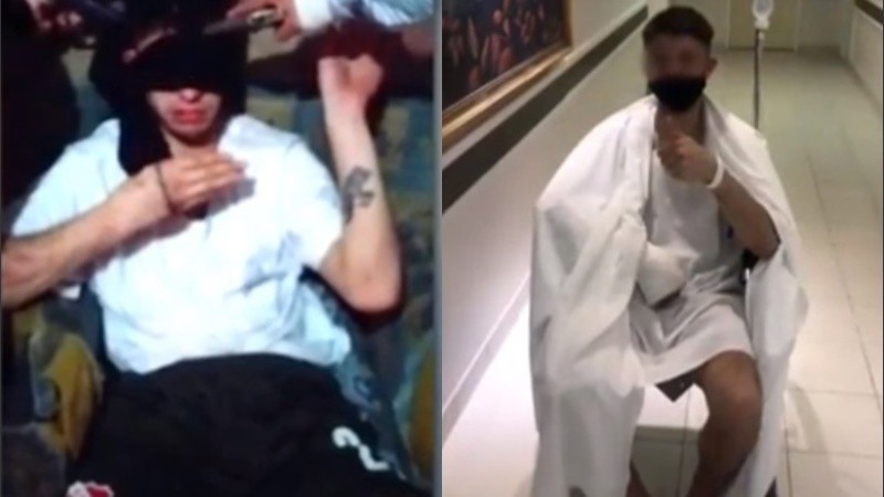 La víctima tuvo que ser intervenida quirúrgicamente luego del secuestro.