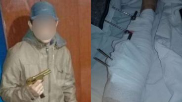 El sicario (izquierda) trató de vengar la balacera que sufrió en octubre (derecha).