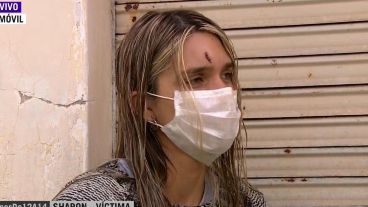 La víctima con las marcas de las terribles agresiones en su rostro