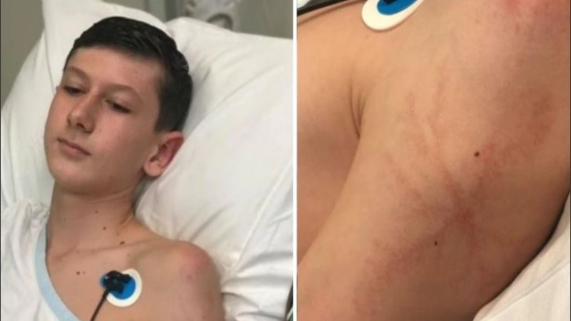 Talyn se recuperó notablemente del rayo que lo atravesó. 