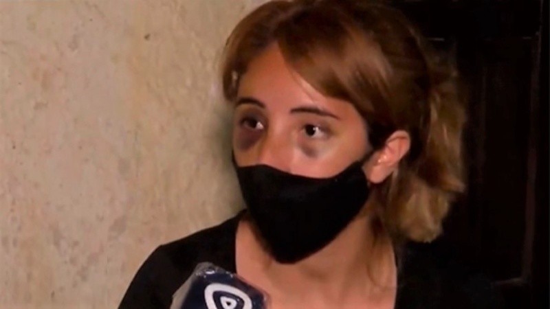 La víctima contó el ataque en diálogo con el programa Telenoche Rosario.