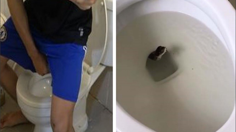 El hombre tardó un año en mejorar la condición de su pene.