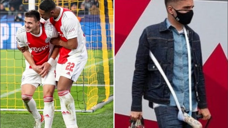 El yeso en su miembro viril es parte de una simple broma. 