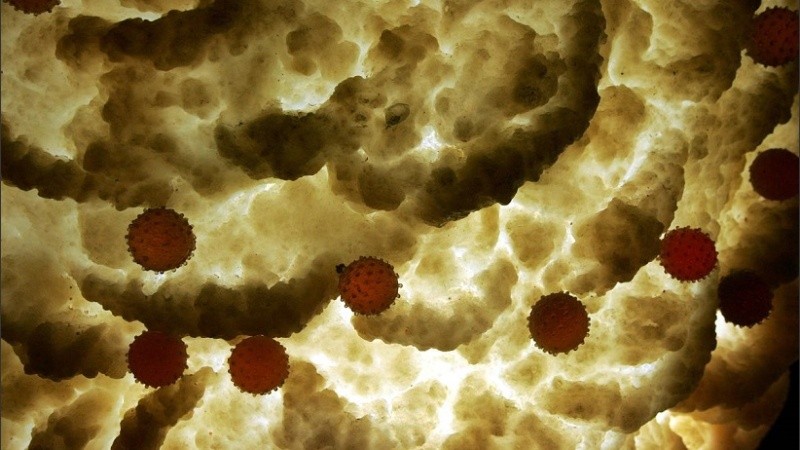 Los científicos están llevando a cabo la más que compleja tarea de curar el VIH en múltiples frentes, incluso a través de la terapia genética.