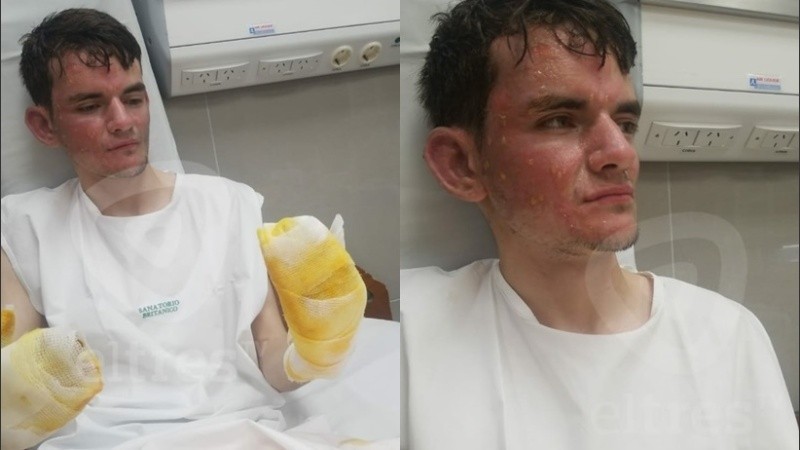 El custodio se resguardó detrás de una escritorio, pero las llamas lo alcanzaron igual.