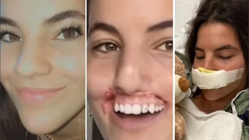 La cirugía estaba programada para el 17 de noviembre.