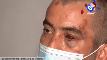 Los golpes en el rosto y el ojo de Ricardo.