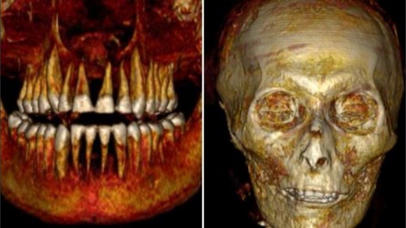 El faraón medía 1,69 metros, estaba circunciso y tenía alrededor de 35 años.