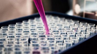 Los anticuerpos son proteínas que el organismo utiliza para defenderse.