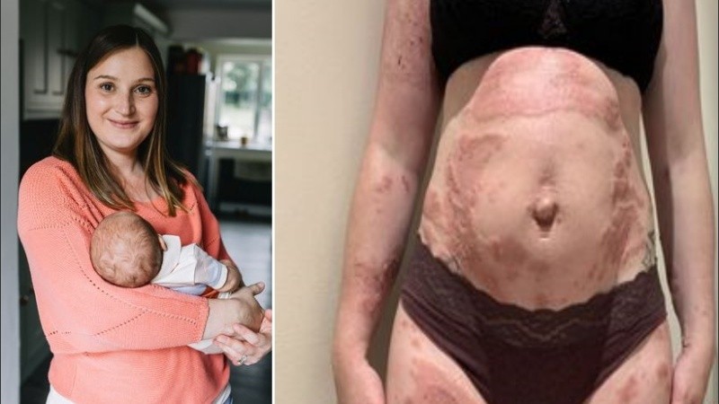 Este tipo de condición afecta a una de cada 50.000 mujeres.