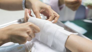 La superficie de la quemadura, su localización y profundidad de heridas determinará el modo de abordaje