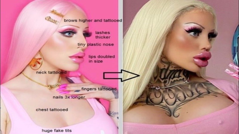 Se operó los senos, la frente, los ojos, las mejillas, los labios y más.