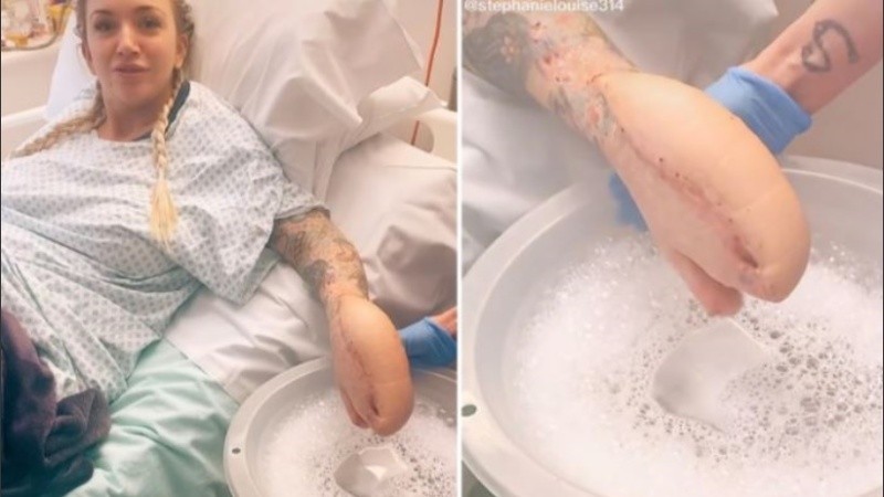 La sepsis genera aproximadamente 11 millones de muertes en todo el mundo.