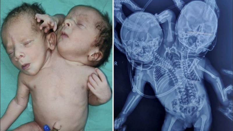 Shaheen Khan y su esposo Sohail esperaban mellizos.