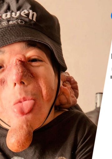 Matías Fernández Burzaco