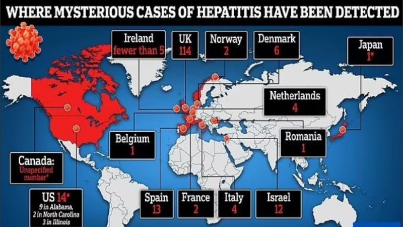La hepatitis es la inflamación del hígado.