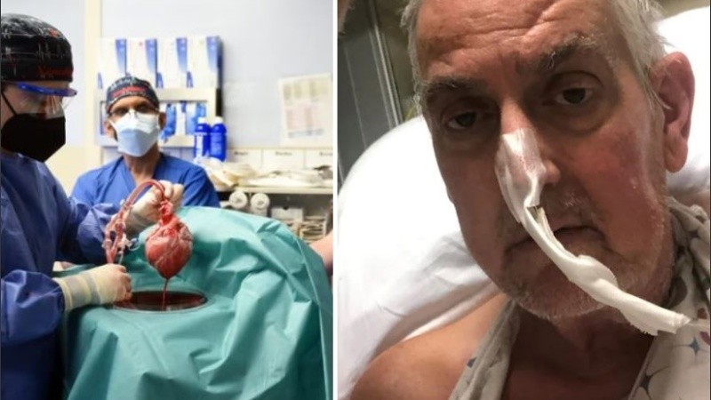 Los expertos dudan en atribuir completamente la muerte de Bennett al virus.