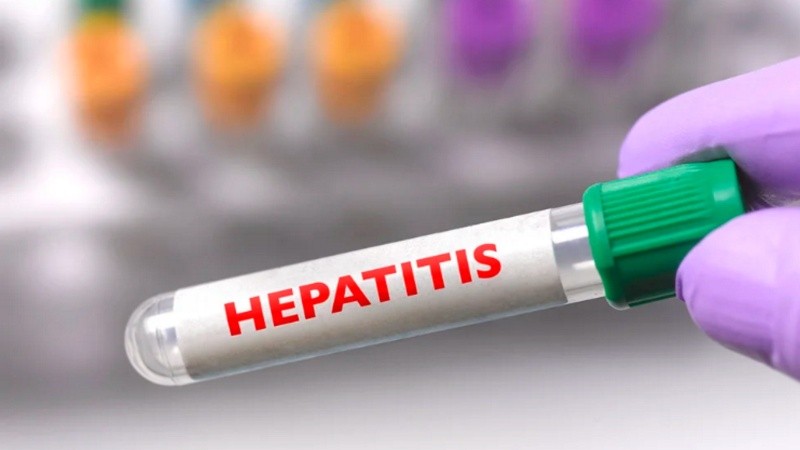 Se la denomina hepatitis de origen desconocido porque los virus comunes que causan la hepatitis: A, B, C y E no se han detectado en ninguno de los casos reportados a nivel mundial.