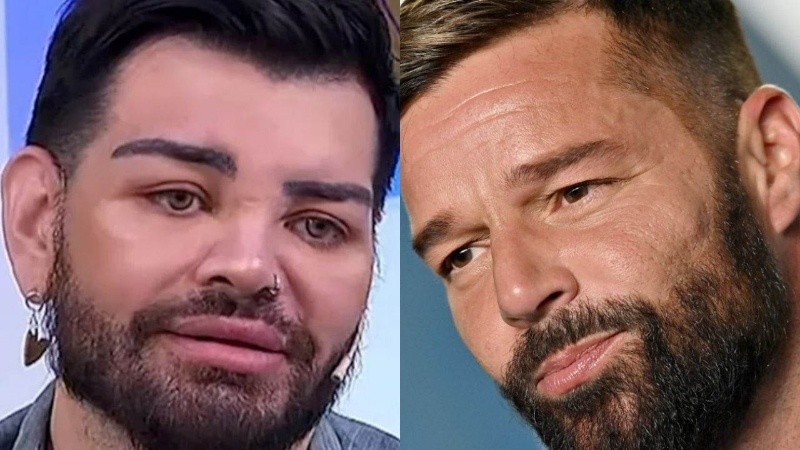 Bajó 92 kilos y a partir de entonces se sometió a más de 20 cirugías para parecerse a Ricky Martin.