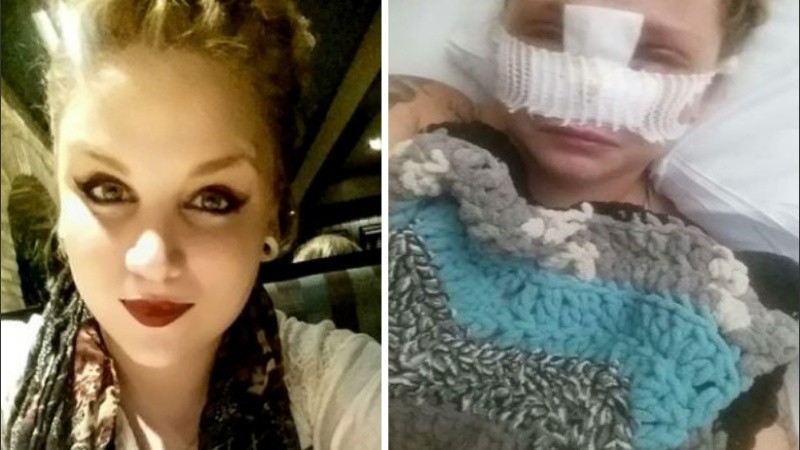 Gabrielle se sometió a siete cirugías y aun necesita más.