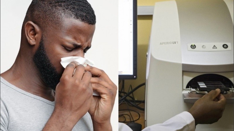 Los síntomas de la enfermedad incluyen fiebre, dolores de cabeza, fatiga y hemorragias.