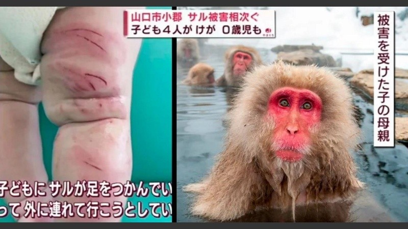 La incidencia de ataques preocupa a las autoridades de Yamaguchi