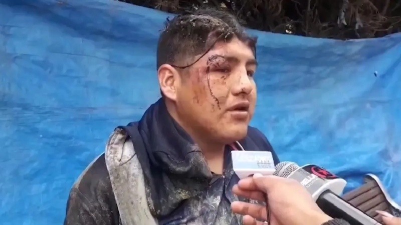 El insólito hecho sucedió en Achacachi, una localidad de Bolivia.