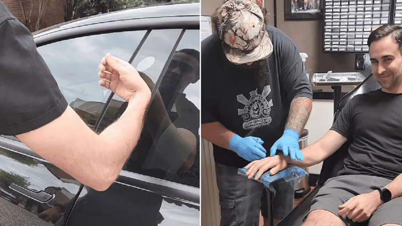 El joven compartió imágenes del procedimiento.