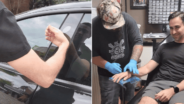 El joven compartió imágenes del procedimiento.