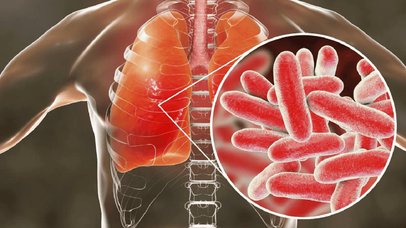 El virus provocó 11 internaciones y cinco muertes en Tucumán hasta el momento.