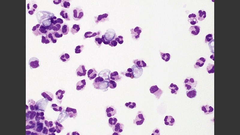 La naegleria crece mejor en aguas con temperaturas generalmente superiores a 30C.