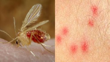 El jején deja una dolorosa mordedura.