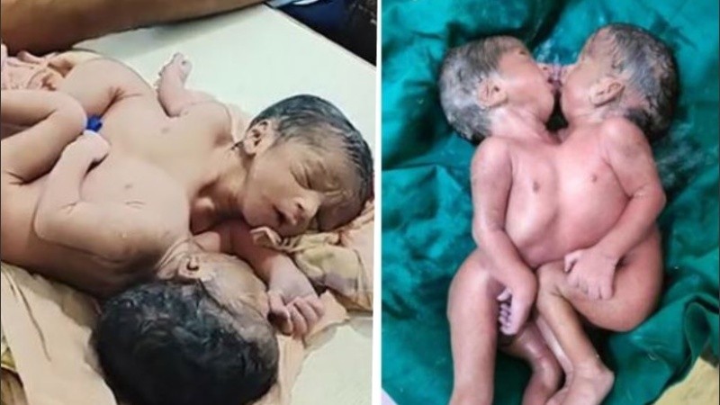 Un equipo de especialistas realizará varios tipos de pruebas para poder separarlos.