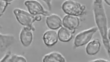 De los 19 hongos identificados, cuatro fueron clasificados de "prioridad crítica".