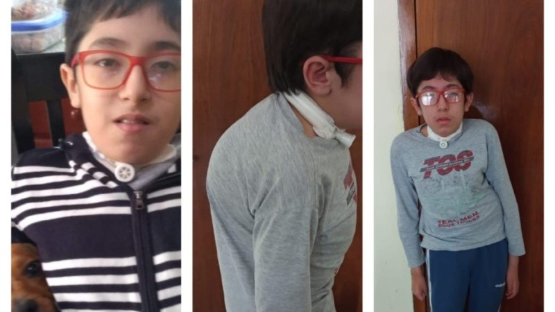 Lucio lleva años esperando una operación que mejore su calidad de vida