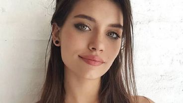 La actriz sufrió un grave accidente mientras cocinaba en su casa.